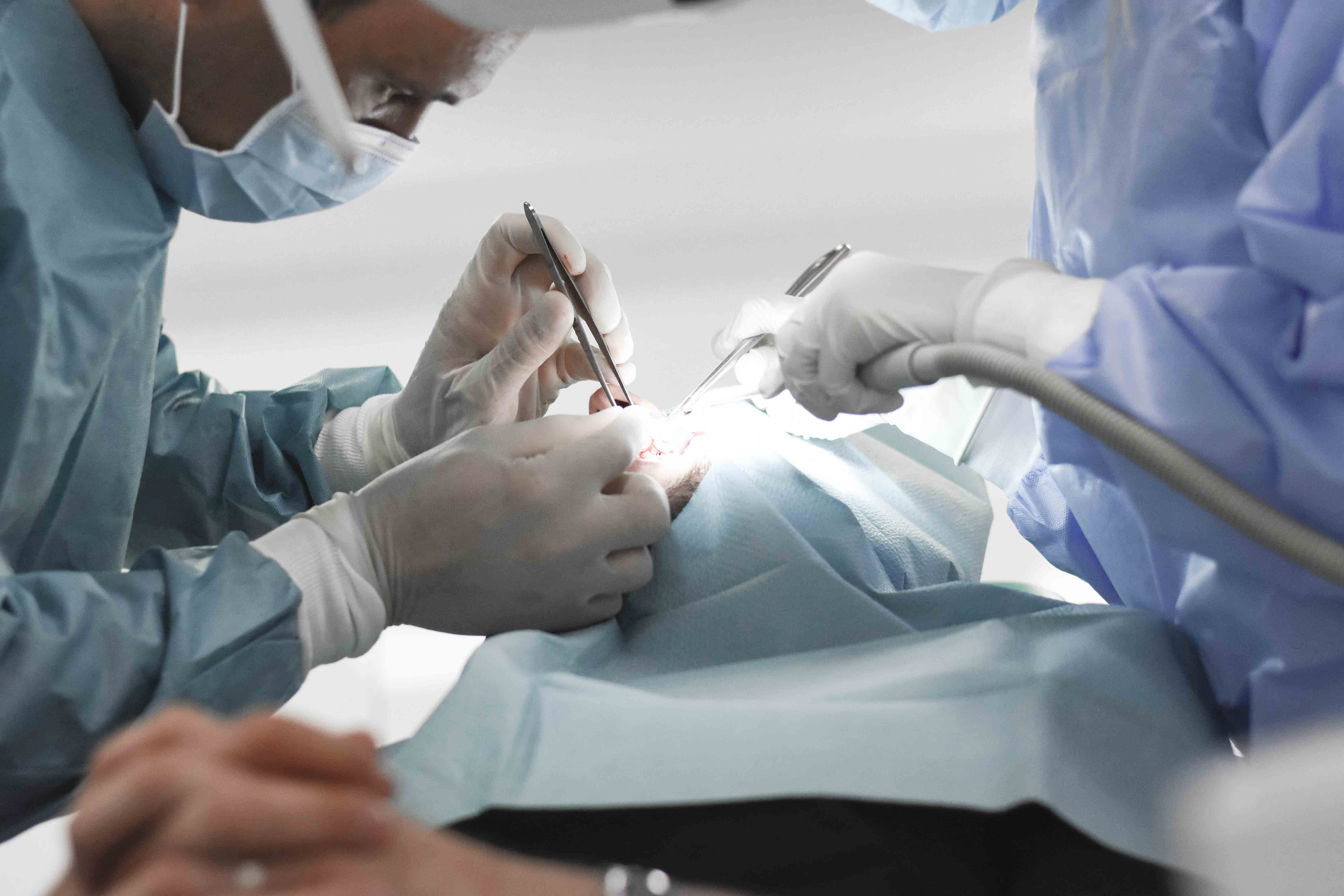 surgery-oroantral-fistula